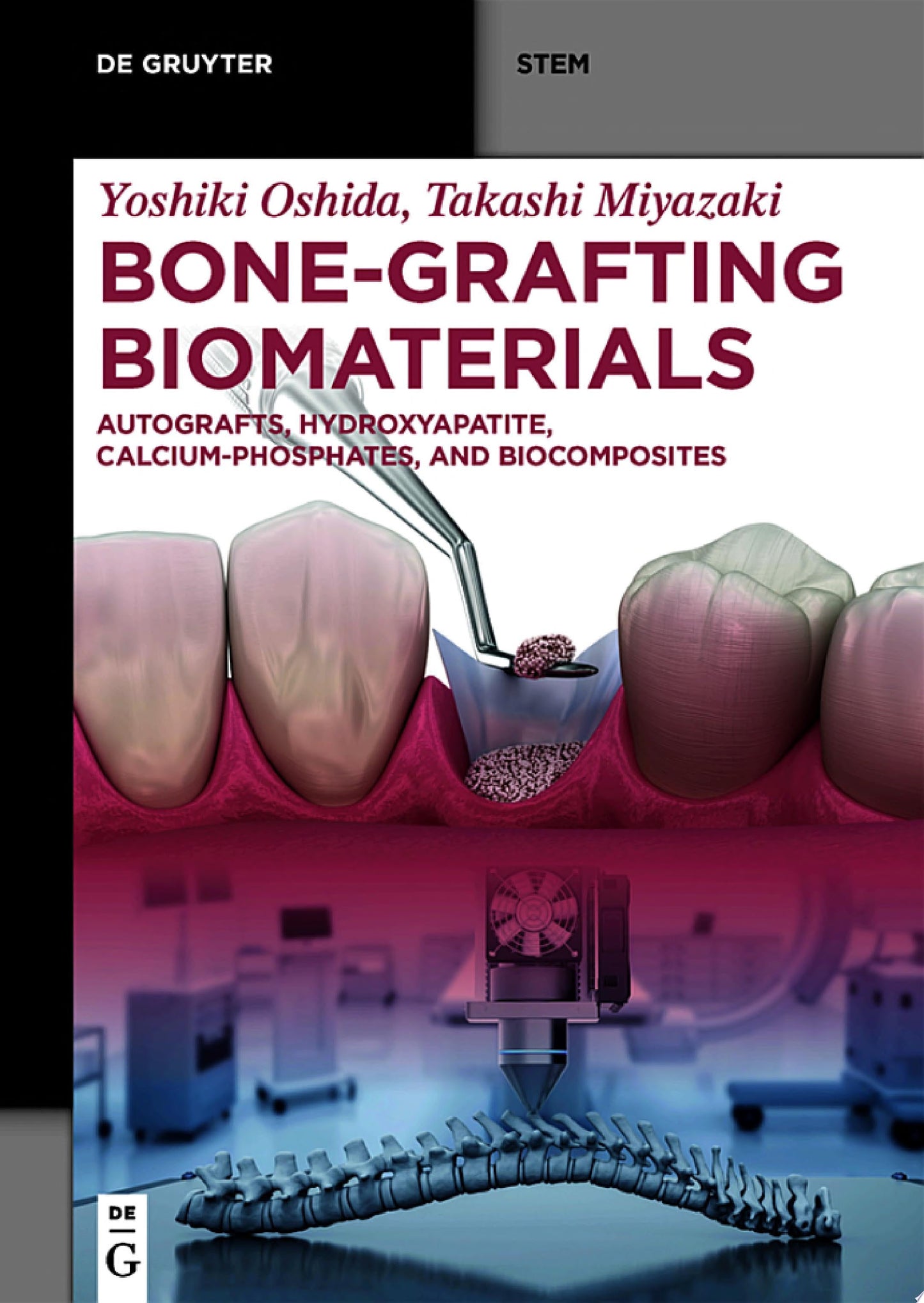 Bone-Grafting Biomaterials: Autografts, Hydroxyapatite, Calcium-Phosphates, and Biocomposites