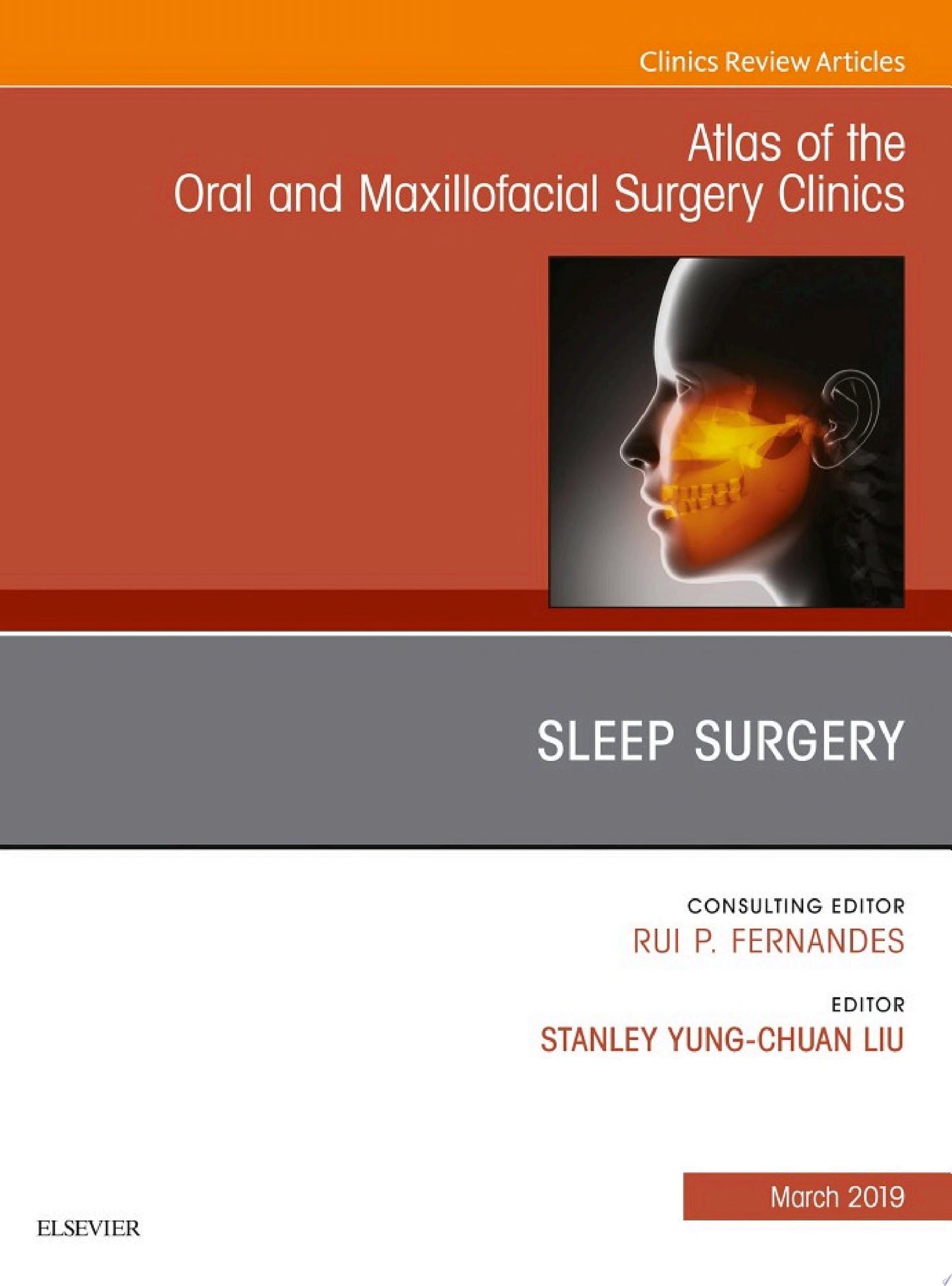 Sleep Surgery, An Issue of Atlas of the Oral & Maxillofacial Surgery Clinics