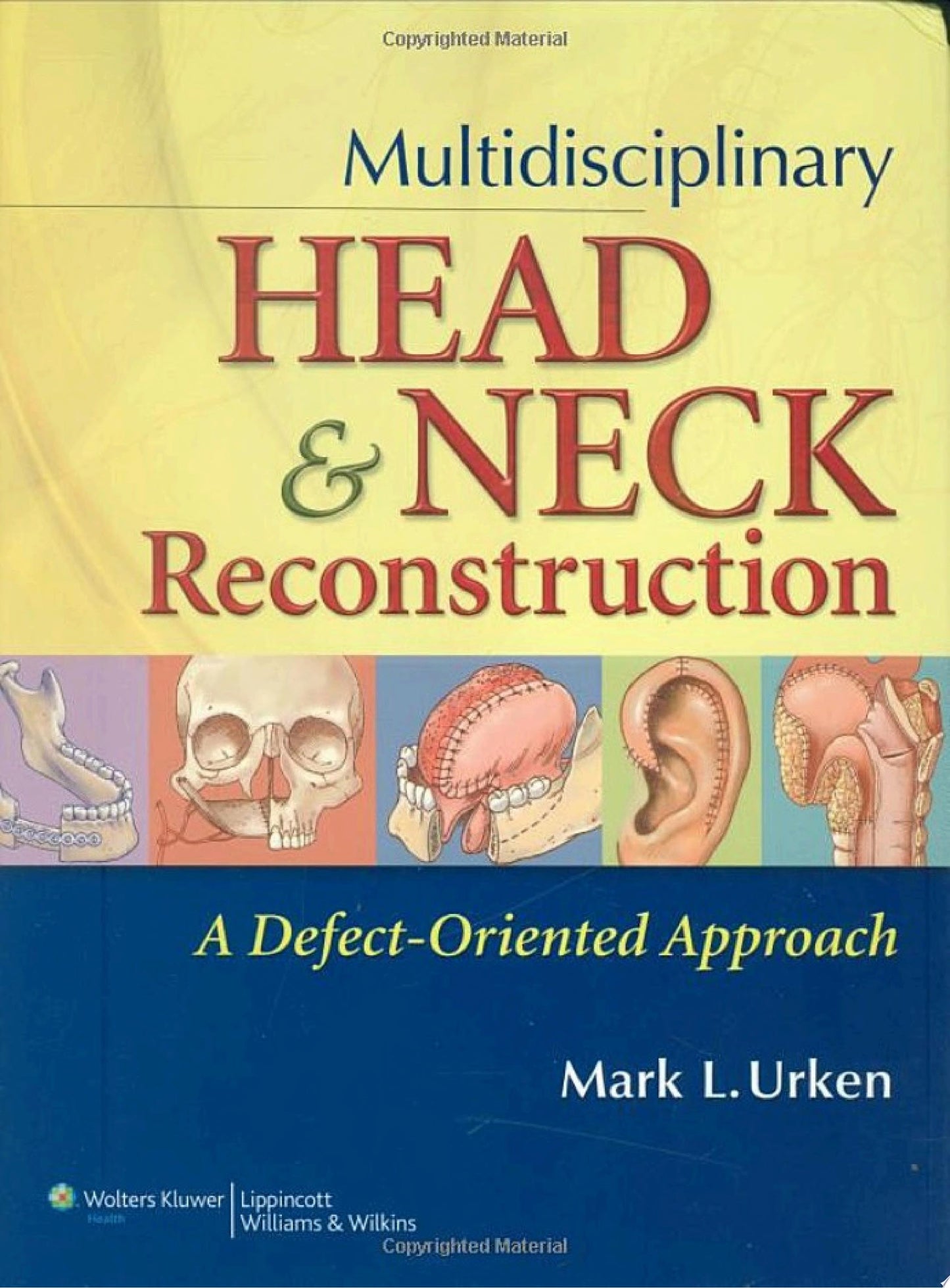 Reconstruction of the Head and Neck: A Defect-Oriented Approach