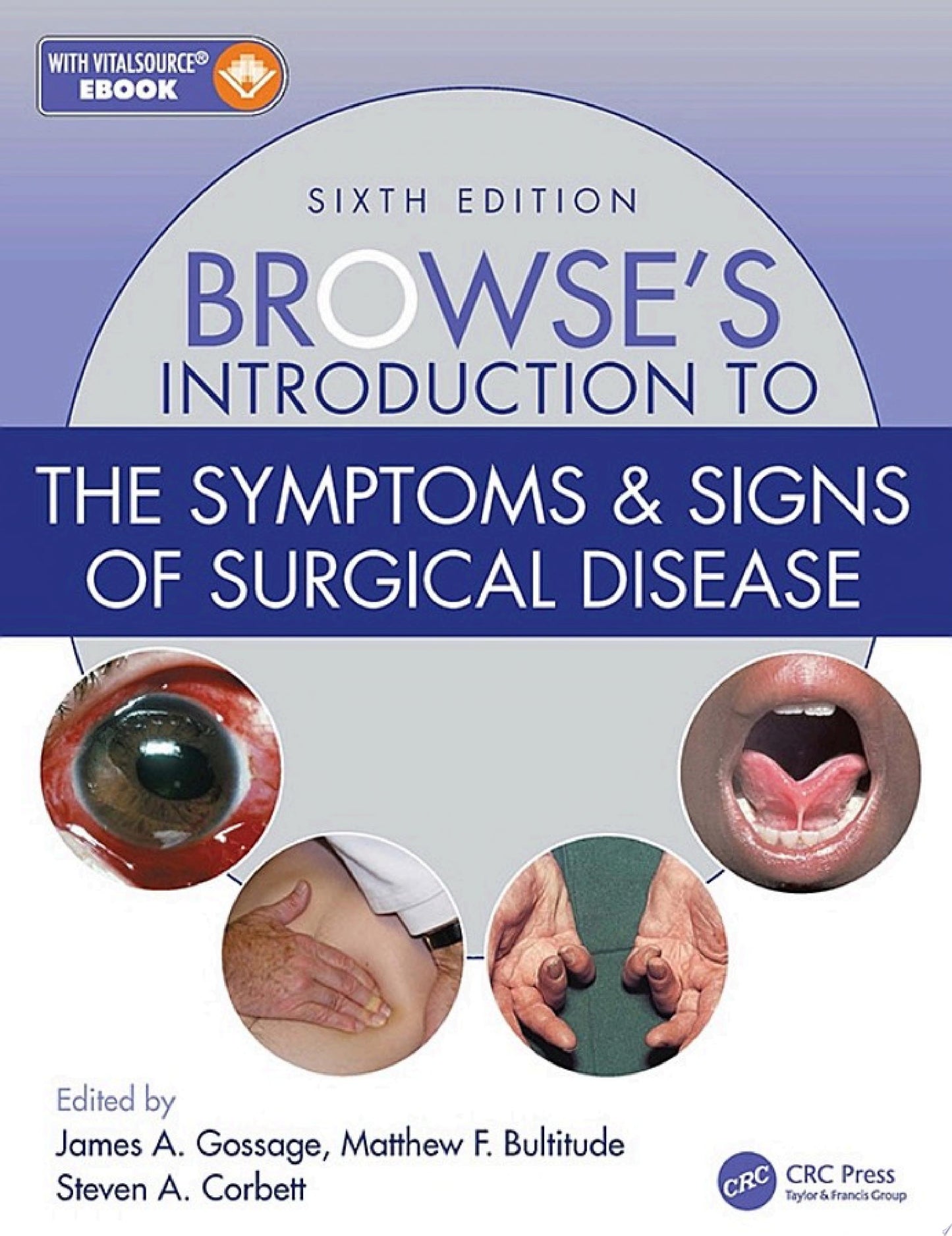 Browse’s Introduction to the Symptoms & Signs of Surgical Disease, 6th Edition