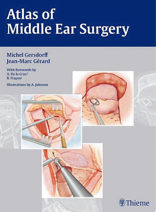Atlas of Middle Ear Surgery