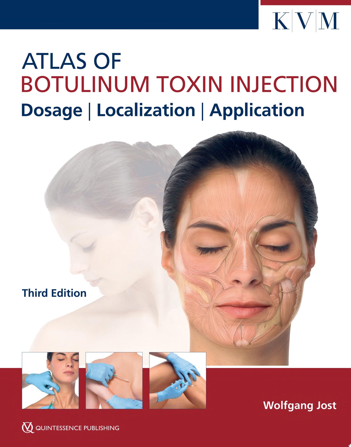 Atlas of Botulinum Toxin Injection: Dosage, Localization, Application, 3rd edition