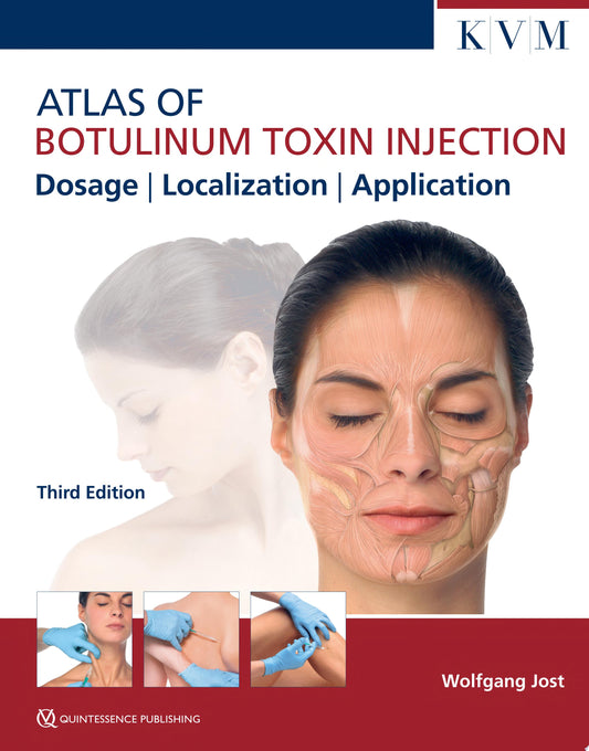 Atlas of Botulinum Toxin Injection: Dosage, Localization, Application, 3rd edition