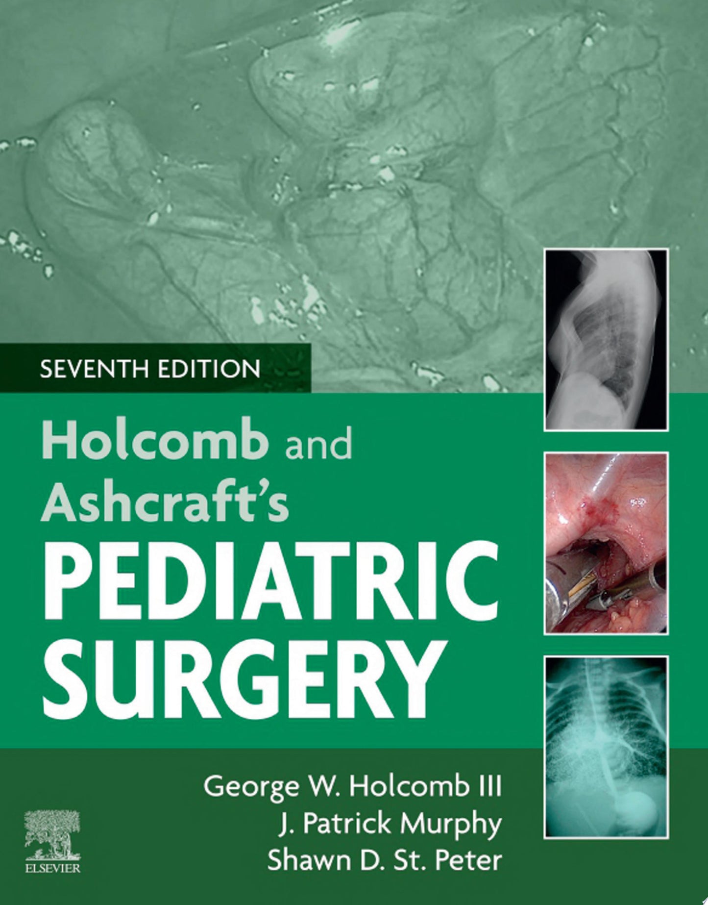 Ashcraft’s Pediatric Surgery, 6th Edition