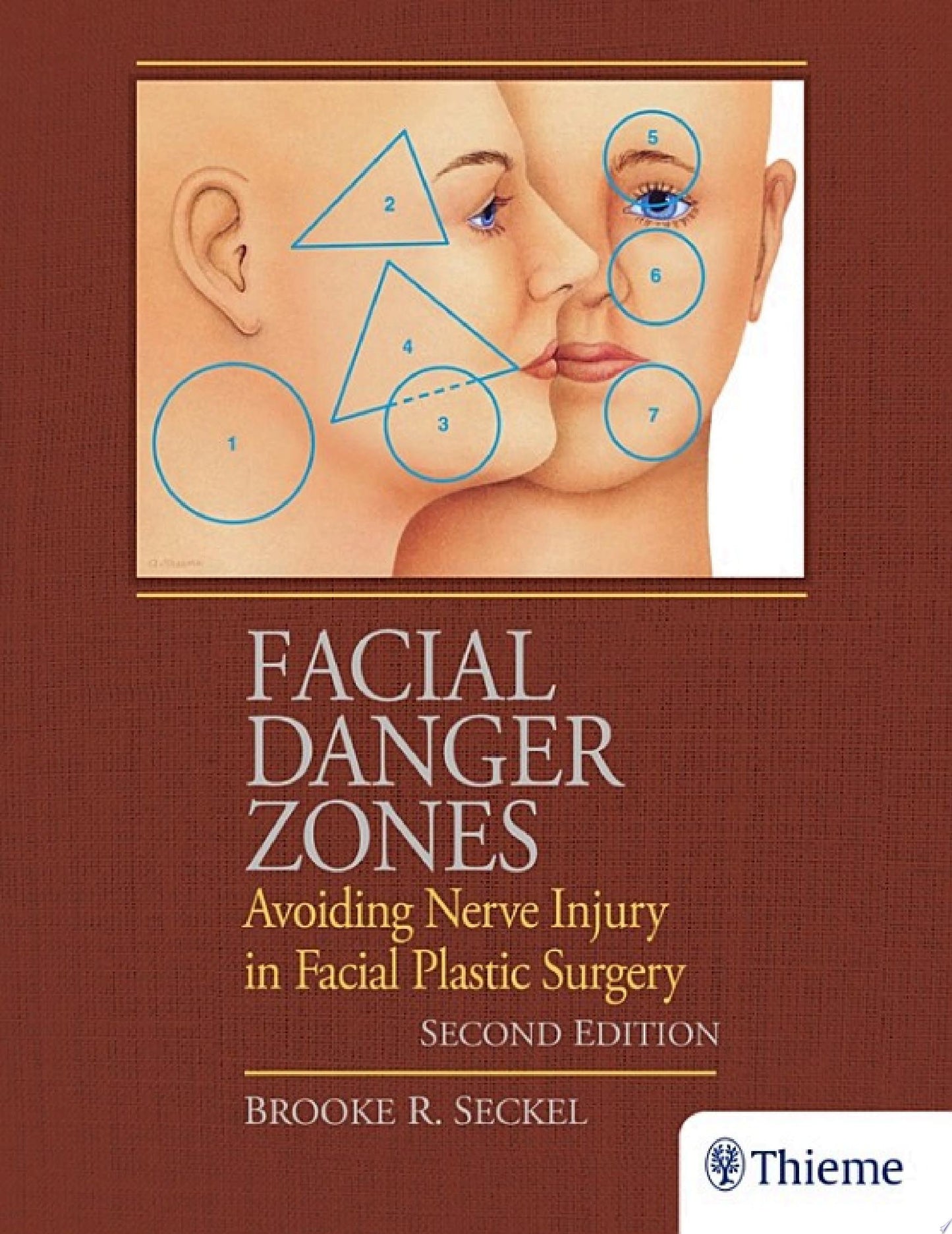 Facial Danger Zones: Avoiding Nerve Injury in Facial Plastic Surgery, 2ed