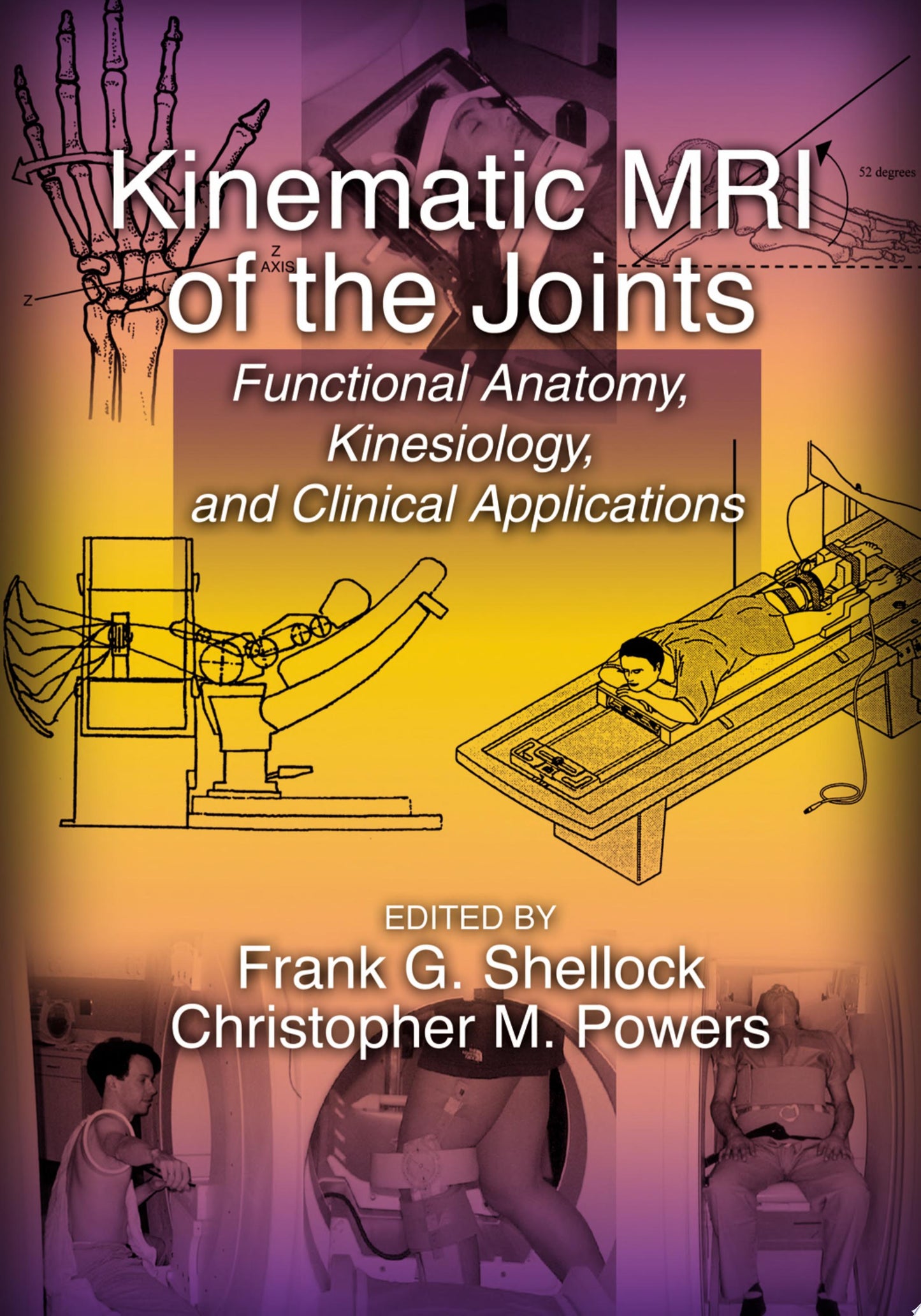 Kinematic MRI of the Joints: Functional Anatomy, Kinesiology, and Clinical Applications