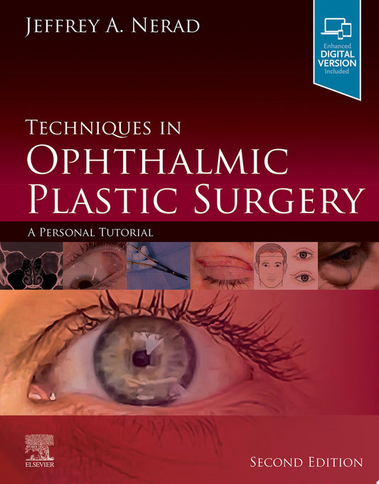 Techniques in Ophthalmic Plastic Surgery , 2nd Edition