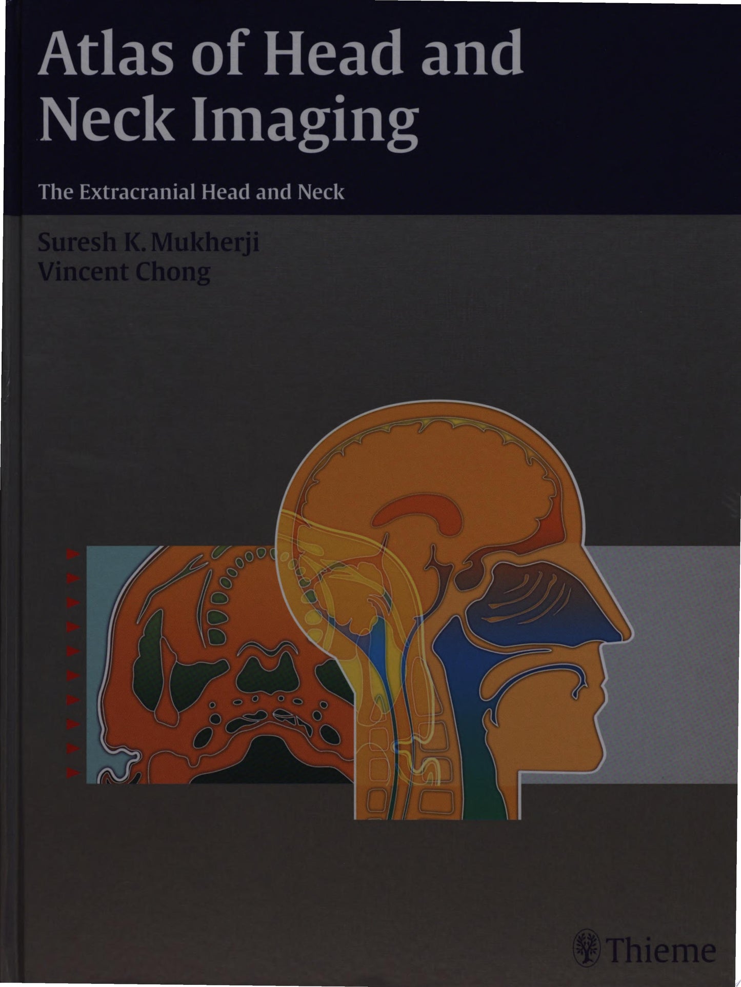 Atlas of Head and Neck Imaging: The Extracranial Head and Neck