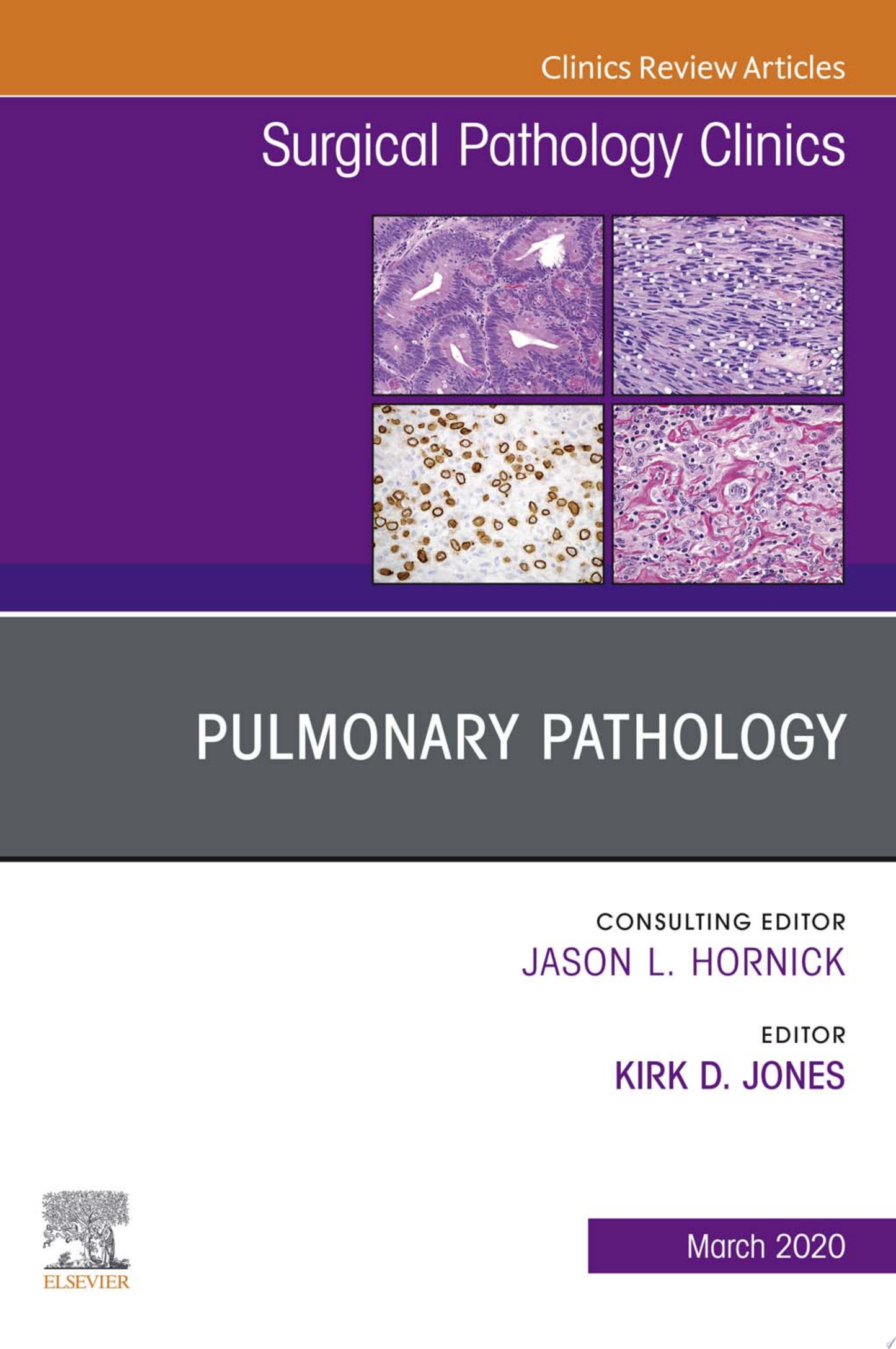 Pulmonary Pathology, An Issue of Surgical Pathology Clinics