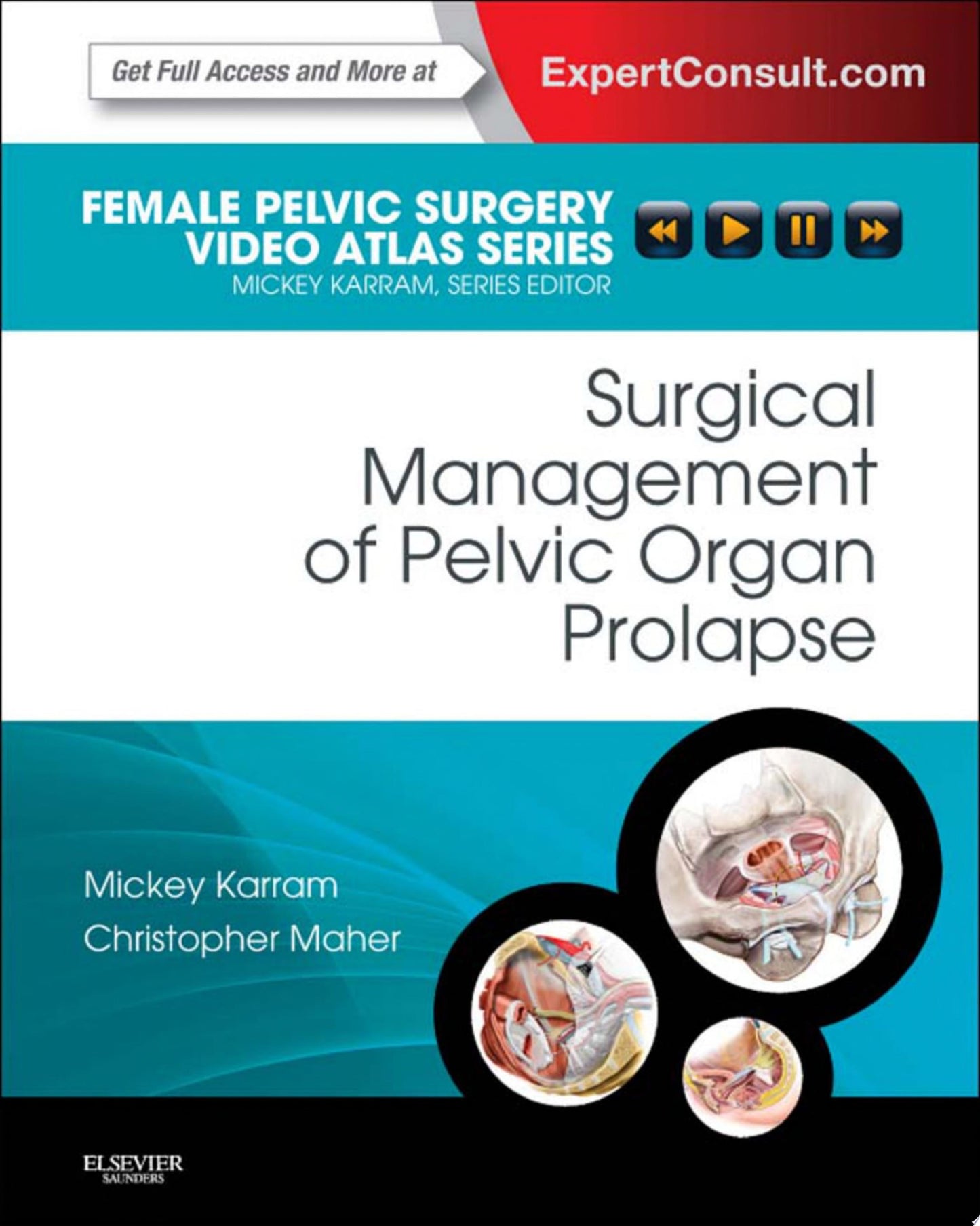 Surgical Management of Pelvic Organ Prolapse: Female Pelvic Surgery Video Atlas Series