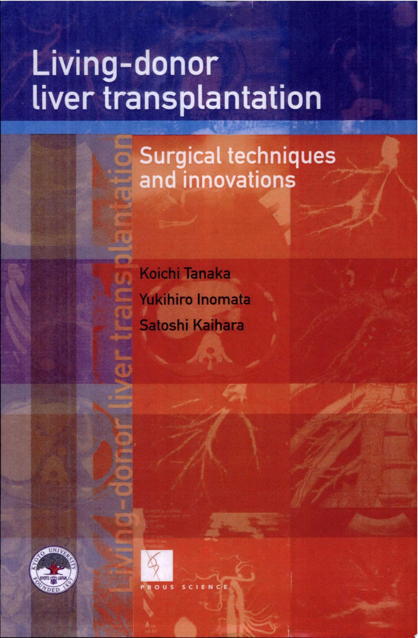 Living Donor Liver Transplantation