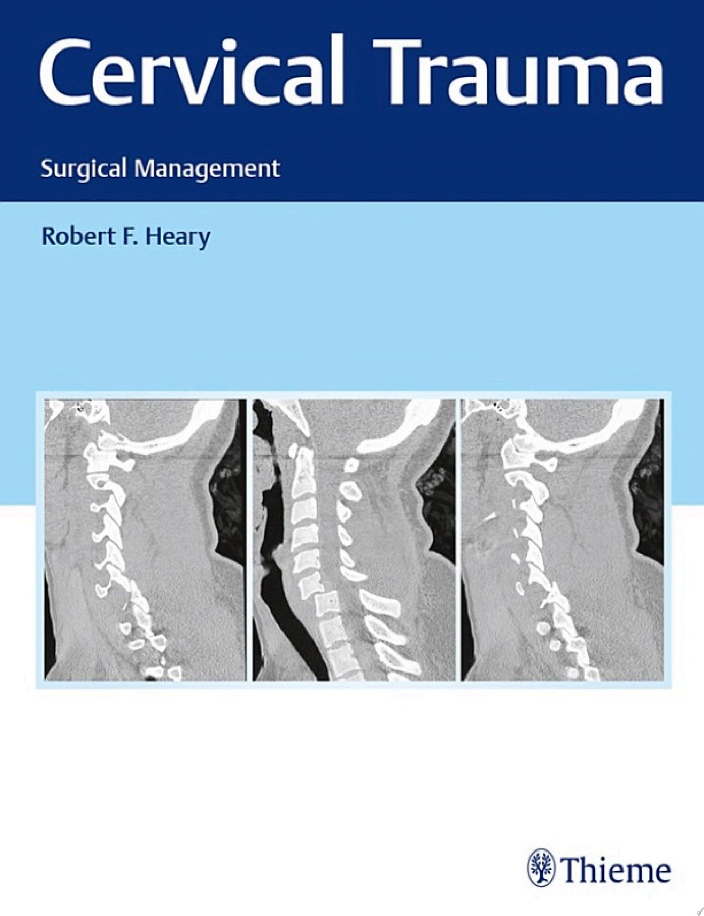 Cervical Trauma: Surgical Management