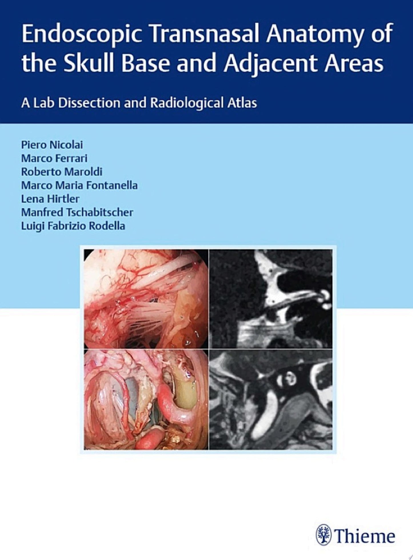 Endoscopic Transnasal Anatomy of the Skull Base and Adjacent Areas: A Lab Dissection and Radiological Atlas