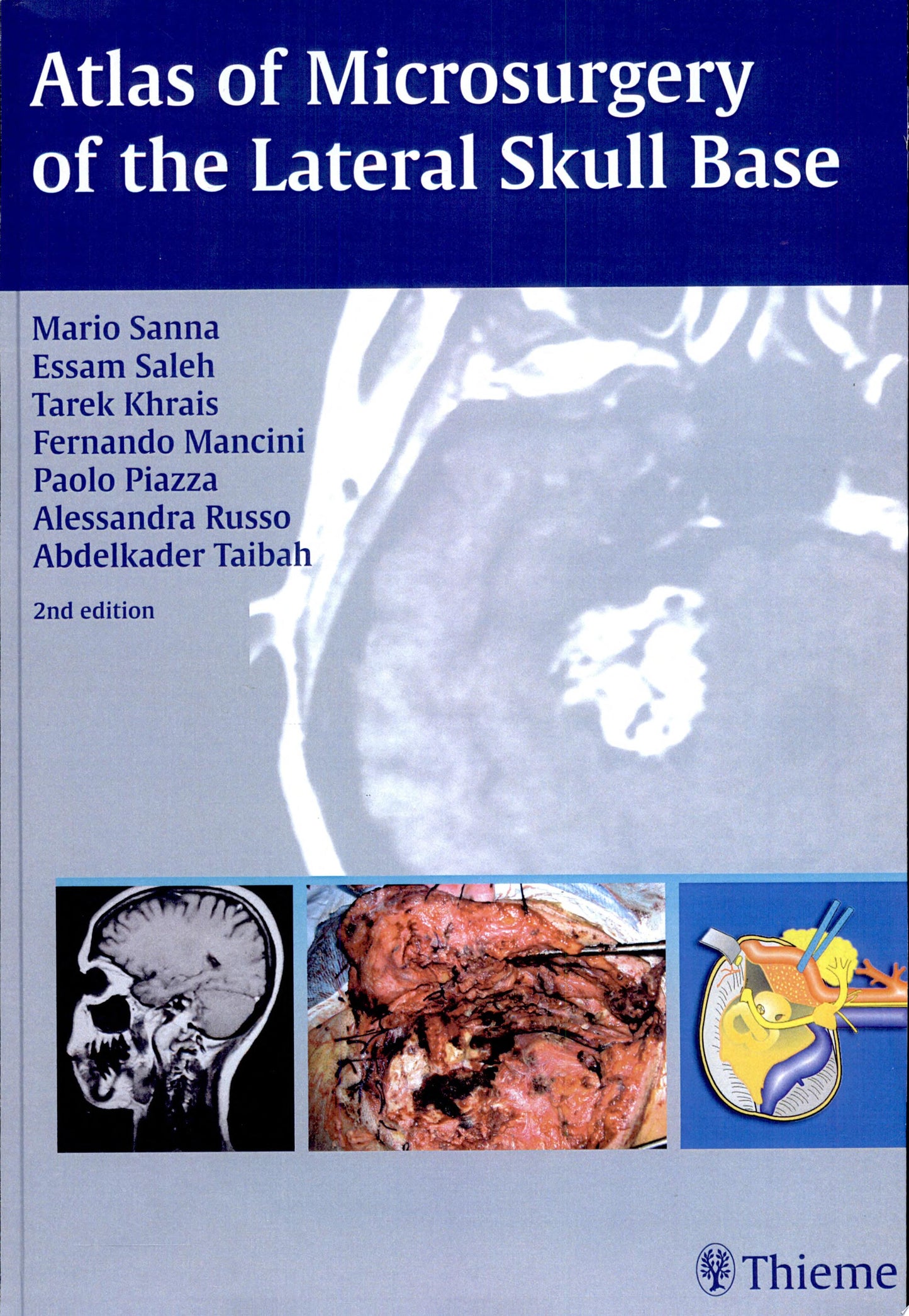 Atlas of Microsurgery of the Lateral Skull Base, 2nd Edition