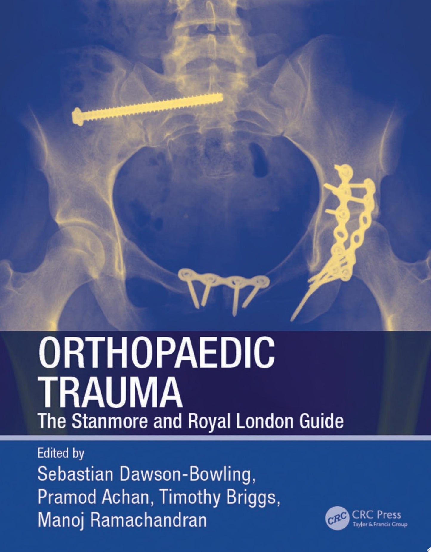 Orthopaedic Trauma: The Stanmore and Royal London Guide