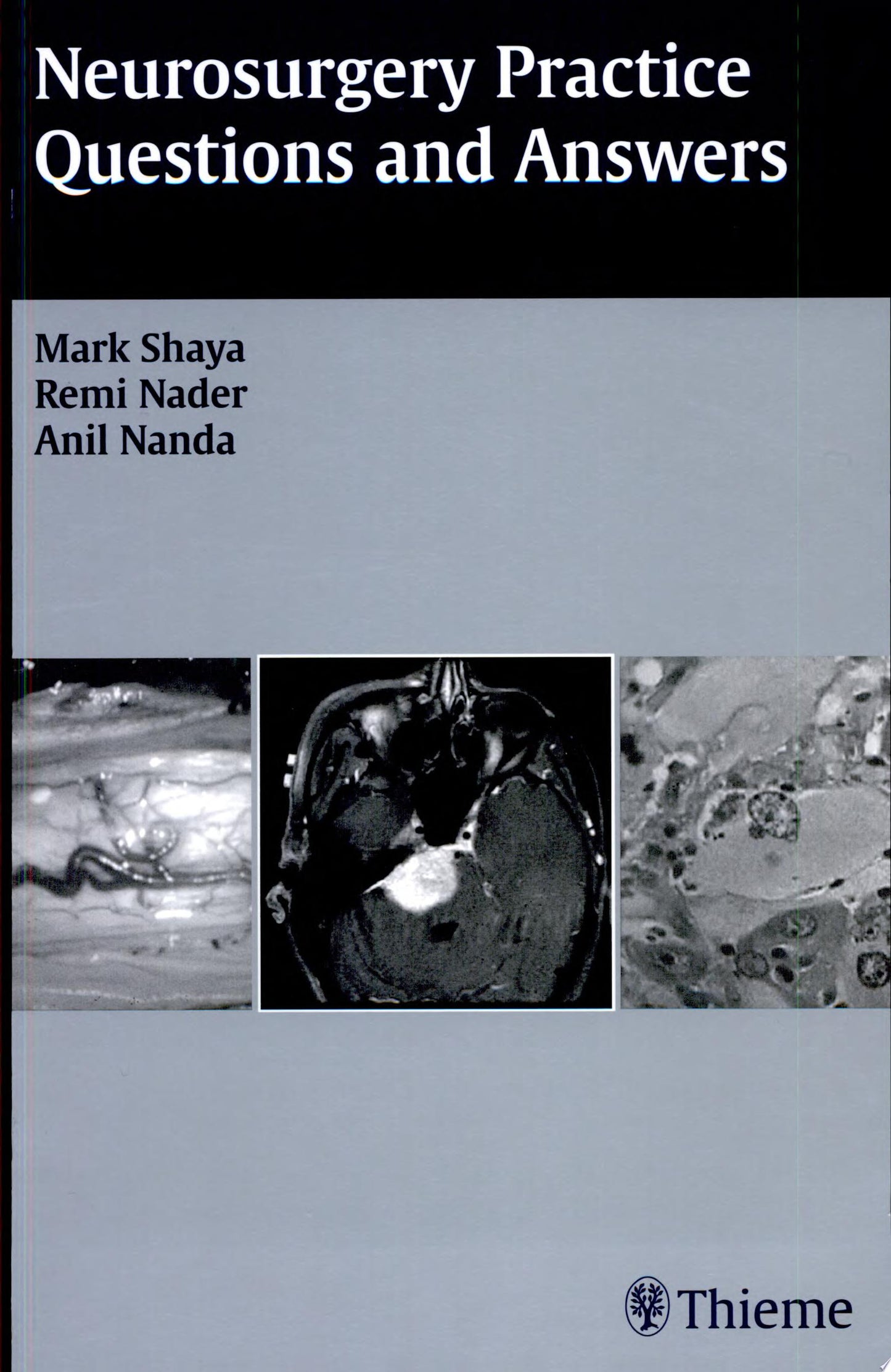 Neurosurgery Practice Questions and Answers