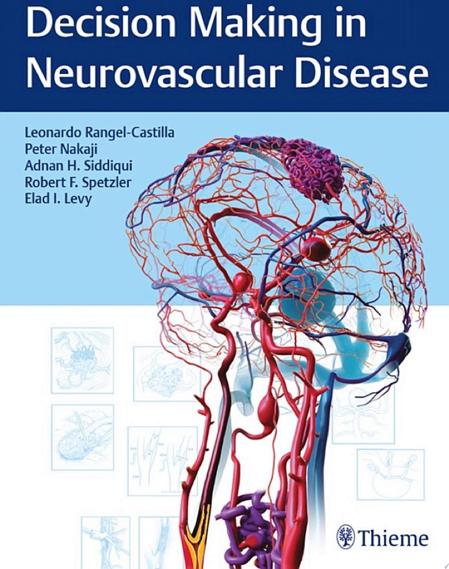 Decision Making in Neurovascular Disease,1ed