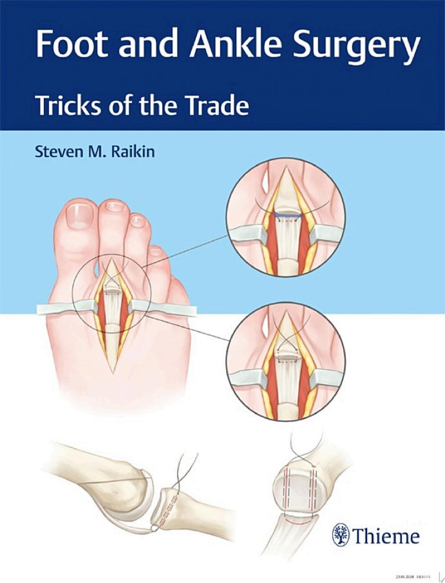 Foot and Ankle Surgery: Tricks of the Trade