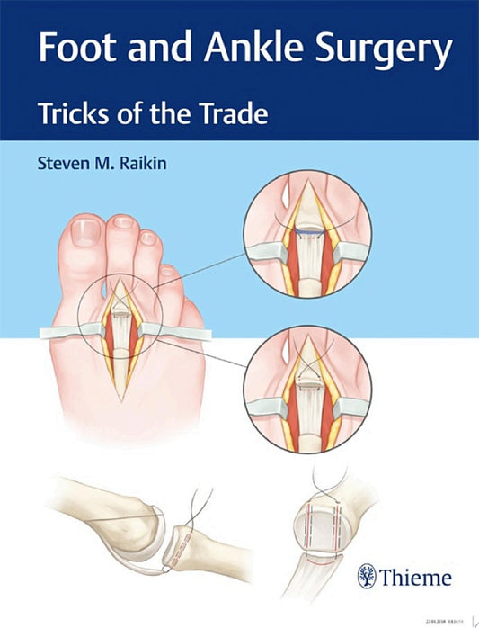 Foot and Ankle Surgery: Tricks of the Trade