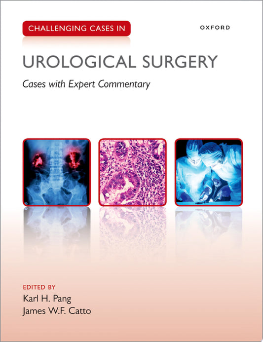 Urological Surgery