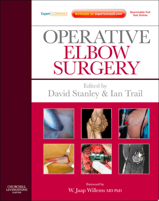 Operative Elbow Surgery: Expert Consult: Online and Print, 1e