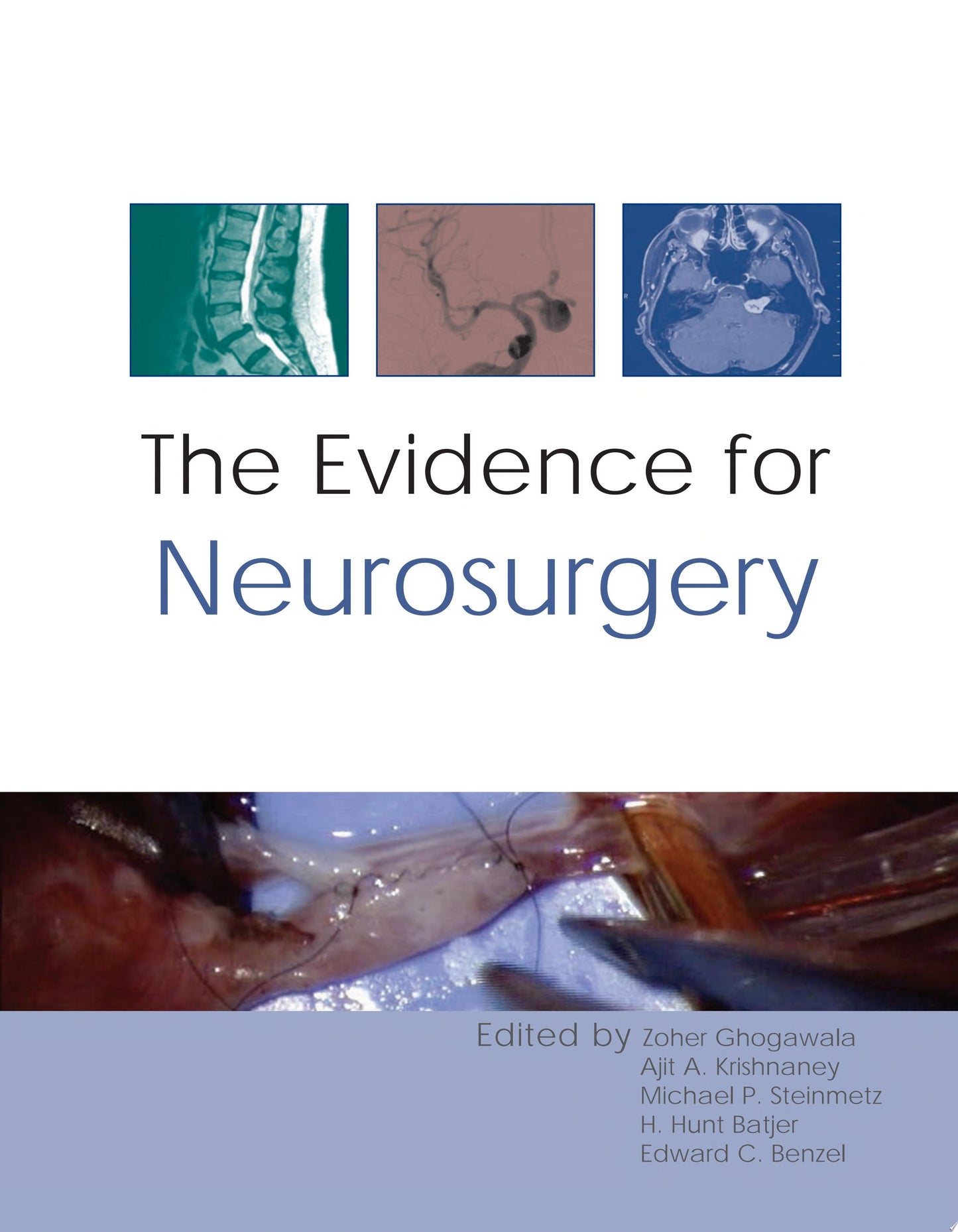 The Evidence for Neurosurgery