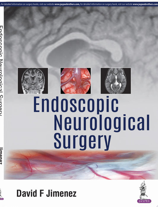 Endoscopic Neurological Surgery