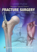 Harborview Illustrated Tips and Tricks in Fracture Surgery, 2nd Edition