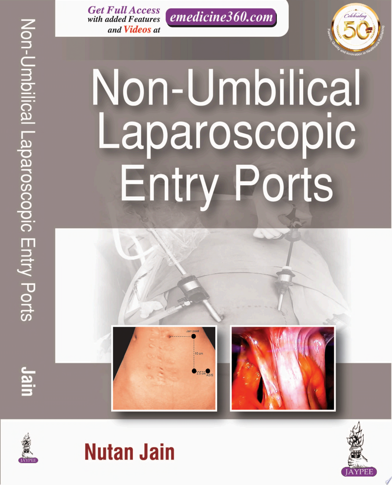 Non-Umbilical Laparoscopic Entry Ports