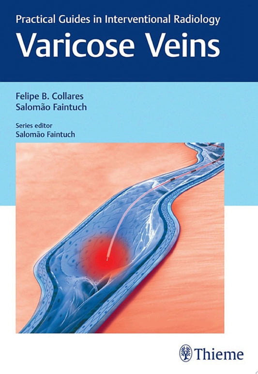 Varicose Veins: Practical Guides in Interventional Radiology, 1st edition