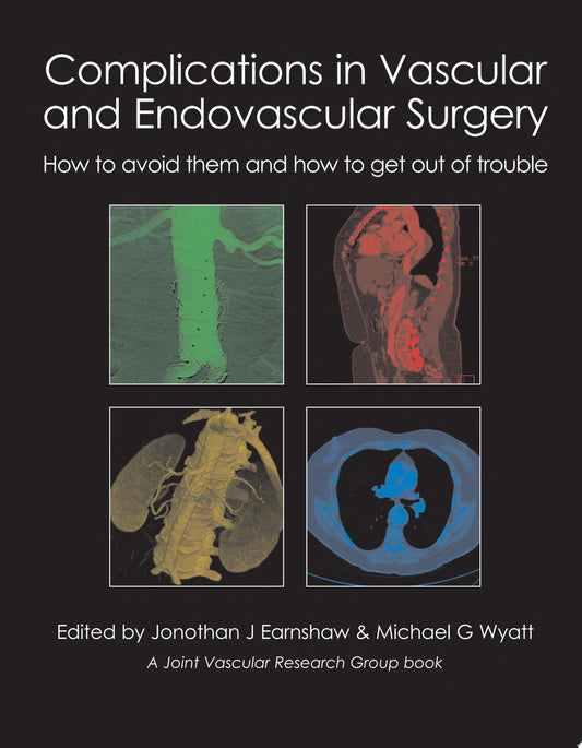 Complications in Vascular and Endovascular Surgery: How to Avoid Them and How to Get Out of Trouble