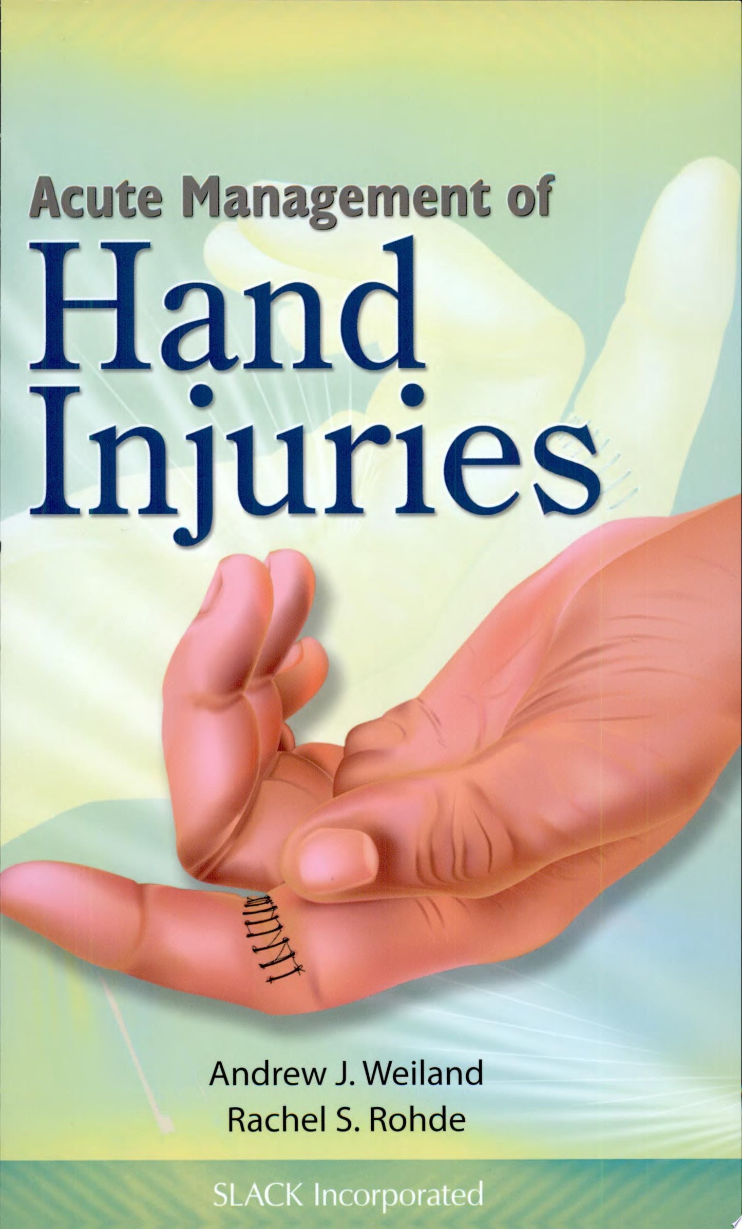 Acute Management of Hand Injuries