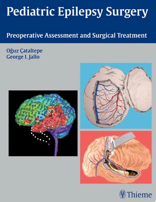 Pediatric Epilepsy Surgery: Preoperative Assessment and Surgical Treatment, 2nd Edition