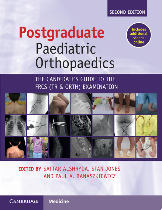 Postgraduate Paediatric Orthopaedics: The Candidate’s Guide to the FRCS Examination