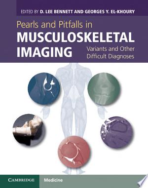 Pearls and Pitfalls in Musculoskeletal Imaging: Variants and Other Difficult Diagnoses