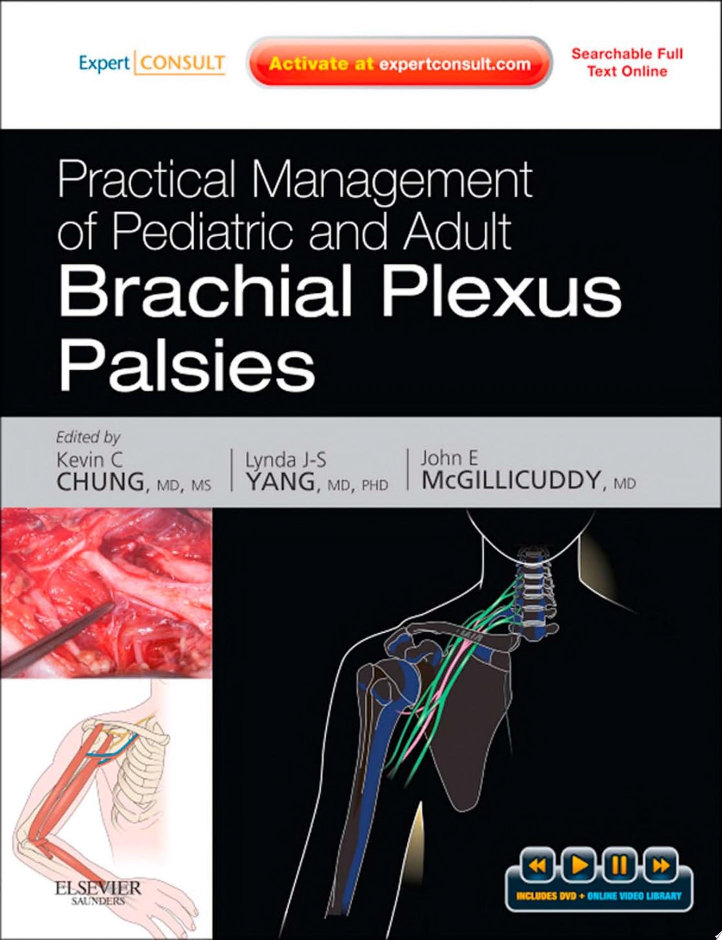 Practical Management of Pediatric and Adult Brachial Plexus Palsies
