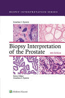 Biopsy Interpretation of the Prostate , 6th Edition