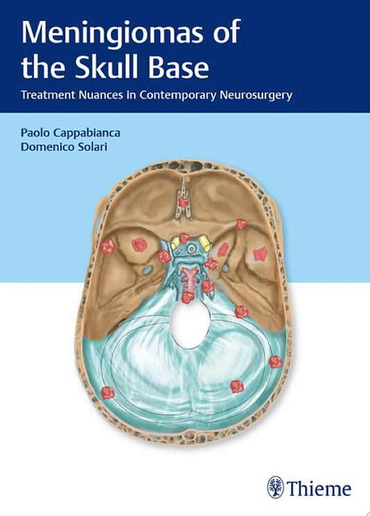 Meningiomas of the Skull Base: Treatment Nuances in Contemporary Neurosurgery