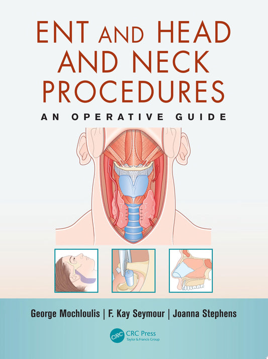 ENT and Head and Neck Procedures: An Operative Guide