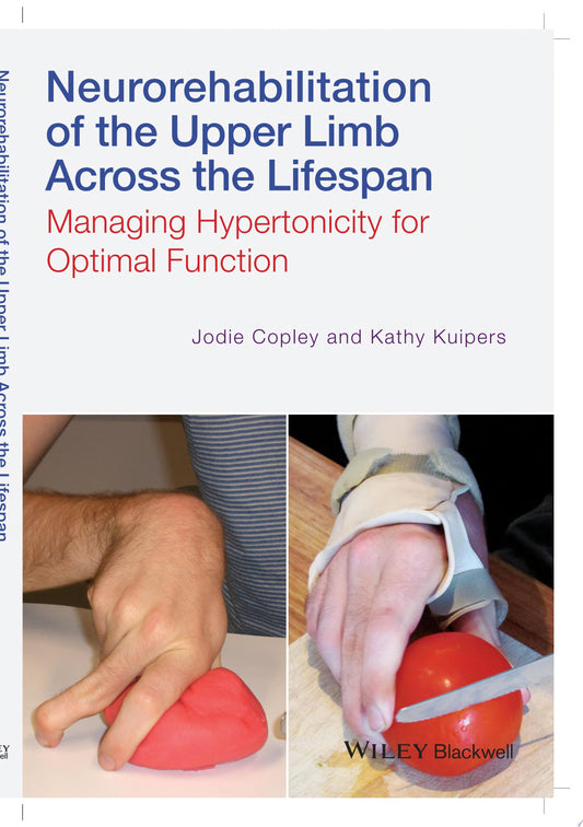 Neurorehabilitation of the Upper Limb Across the Lifespan: Managing Hypertonicity for Optimal Function