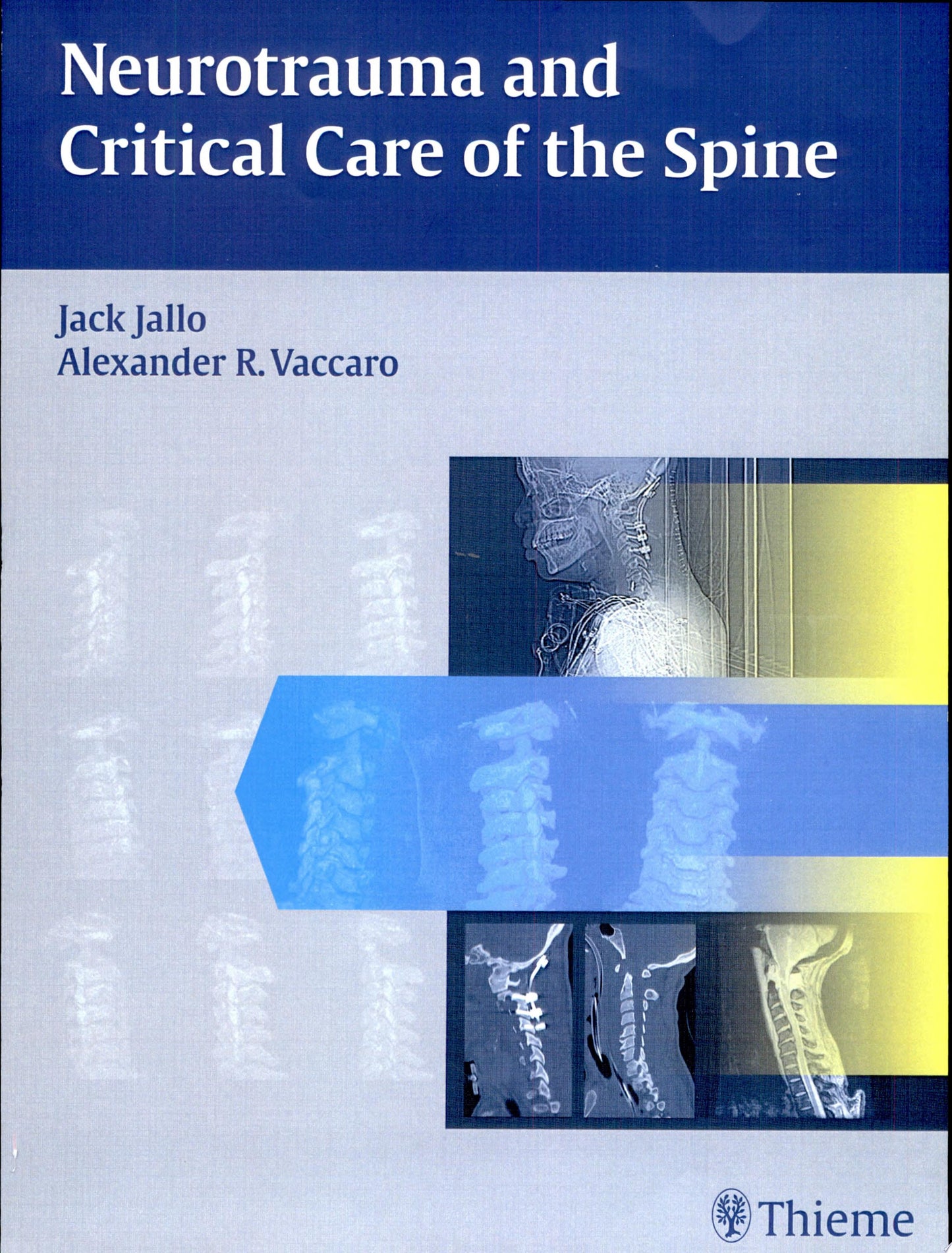 Neurotrauma and Critical Care of the Spine