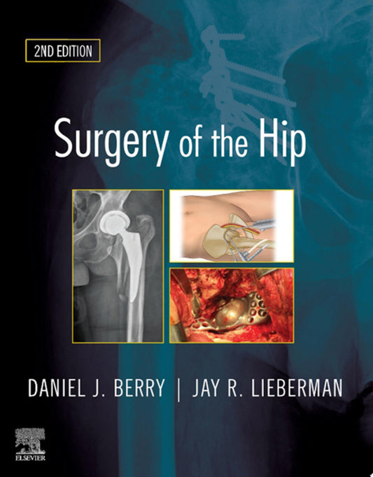 Surgery of the Hip, 2nd Edition