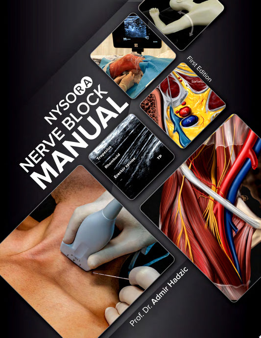 NYSORA Nerve Block Manual