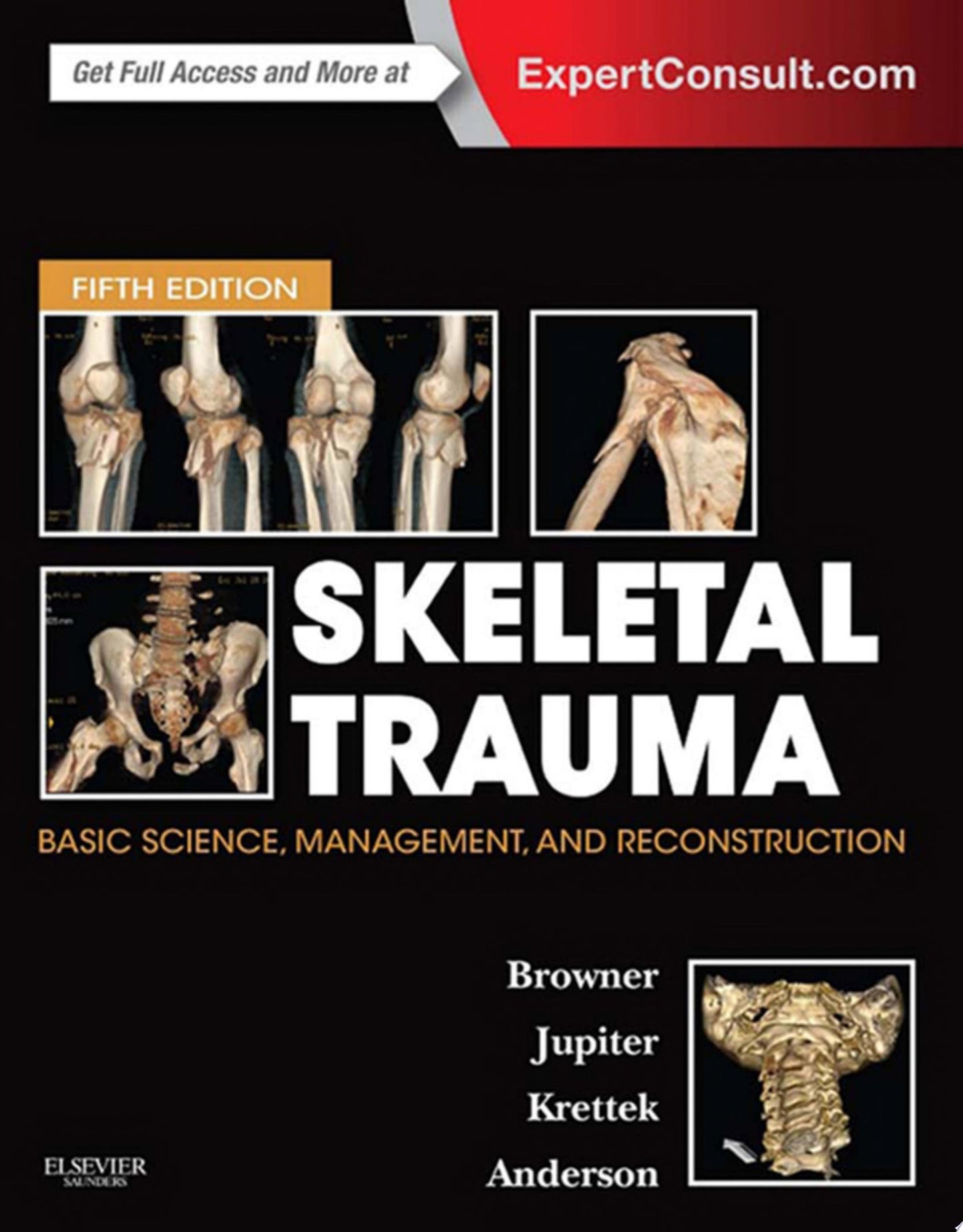Master Techniques in Orthopaedic Surgery: Soft Tissue Surgery, 2nd Edition