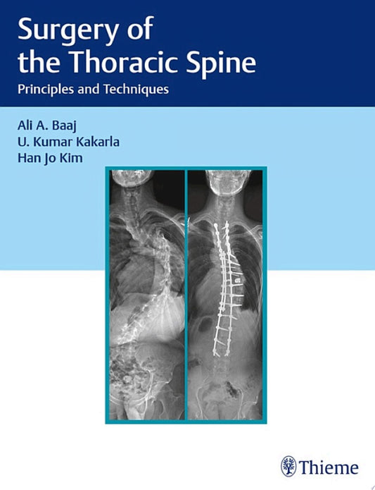 Surgery of the Thoracic Spine: Principles and Techniques