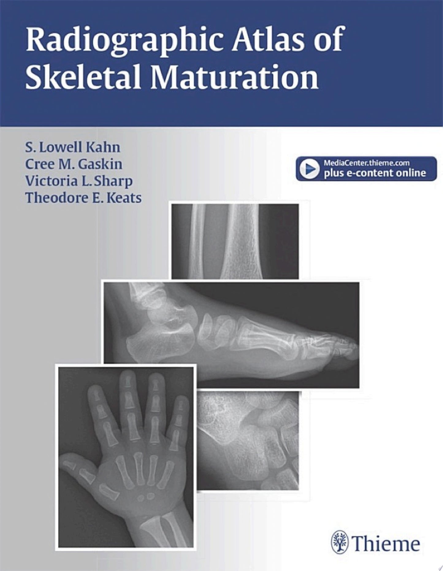 Radiographic Atlas of Skeletal Maturation