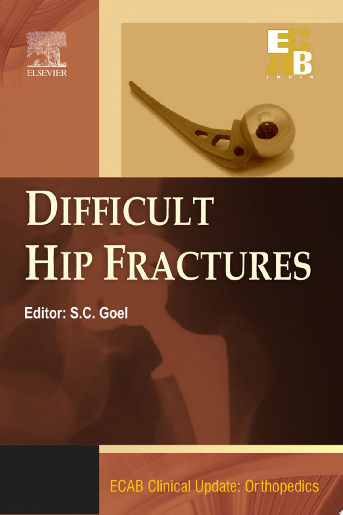 Difficult Hip Fracture – ECAB