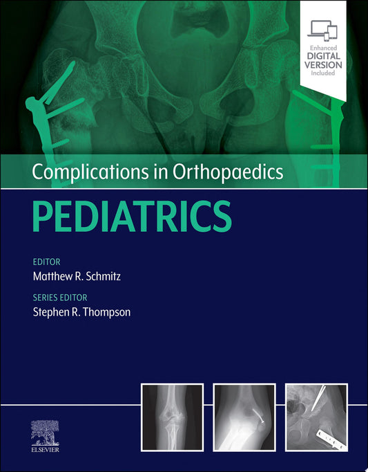 Orthopaedic Knowledge Update: Pediatrics, 4th Edition