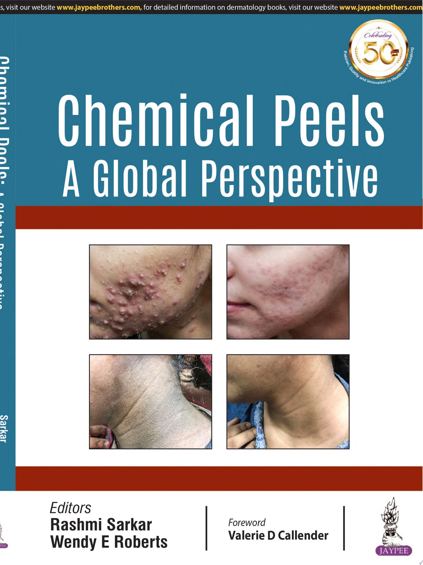 Chemical Peels: A Global Perspective