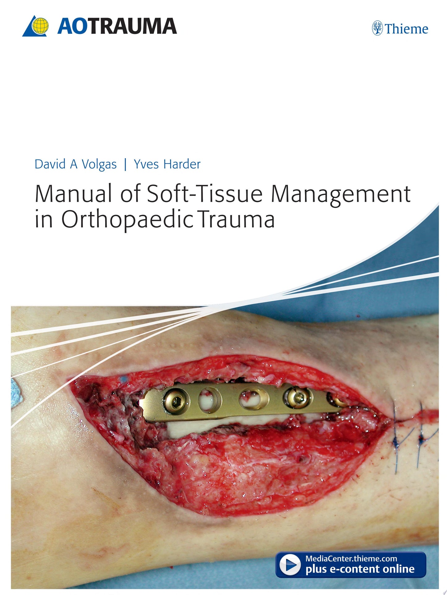 Manual of Soft-tissue Management in Orthopaedic Trauma